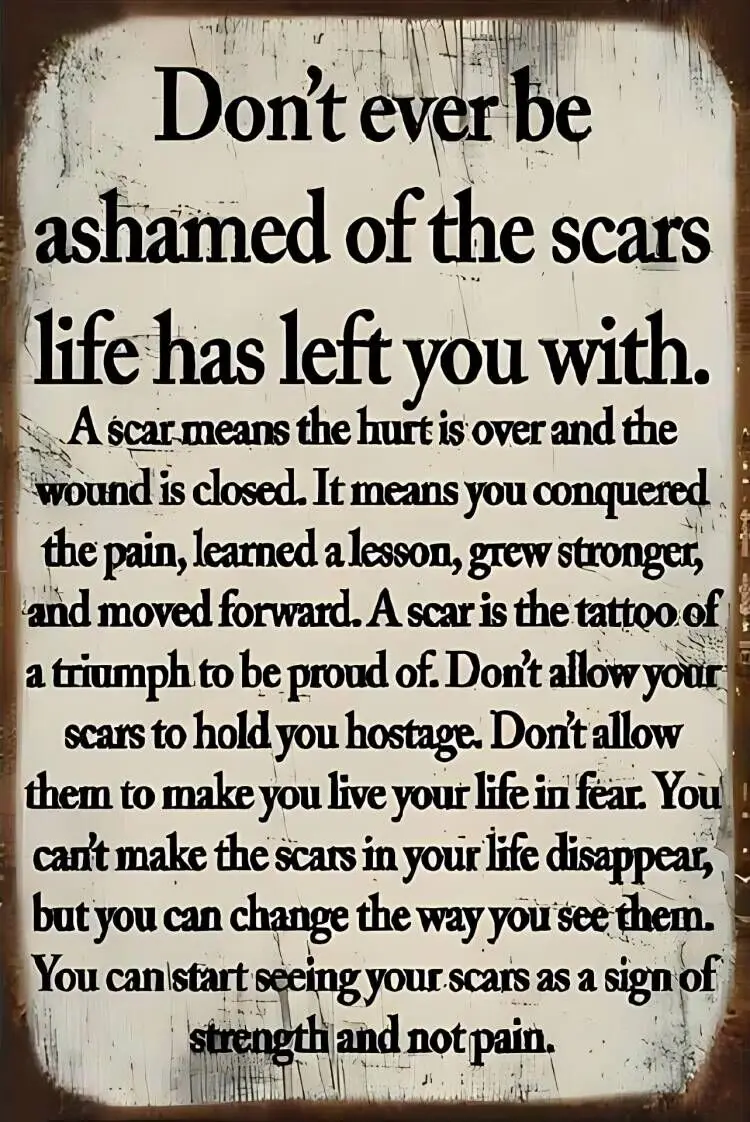 Inspirierendes Metallschild „Don't Be Ashamed of Scars“ – Motivierendes Zitat als Wanddekoration für Zuhause und Büro, Retro-Eisengeschenk