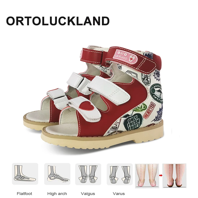 Ortoluckland Kids Girl Sandals Children Orthopedic Pattern Leather Shoes Toddler Summer Flatfeet Footwear 3 To 10Years Age