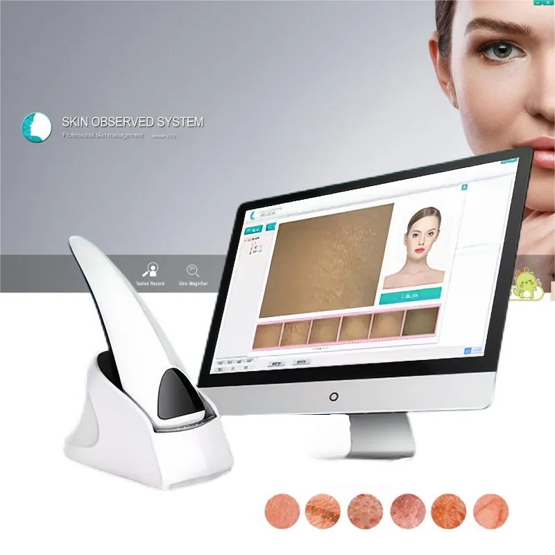 

Smart skin detector beauty instrument dedicated facial pore moisture analysis wrinkle acne detection dermis/epidermis/UV layer