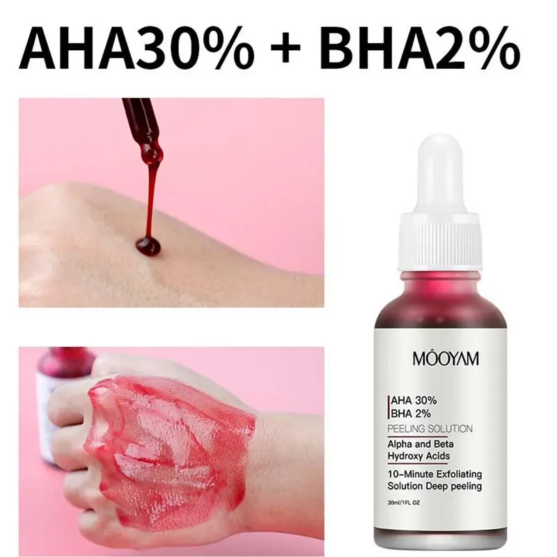 New Face Makeup Peeling Solution AHA 30% + BHA 2% Acne Removing Serum Repair Hyaluronic Acid Face Skin Care Treatments