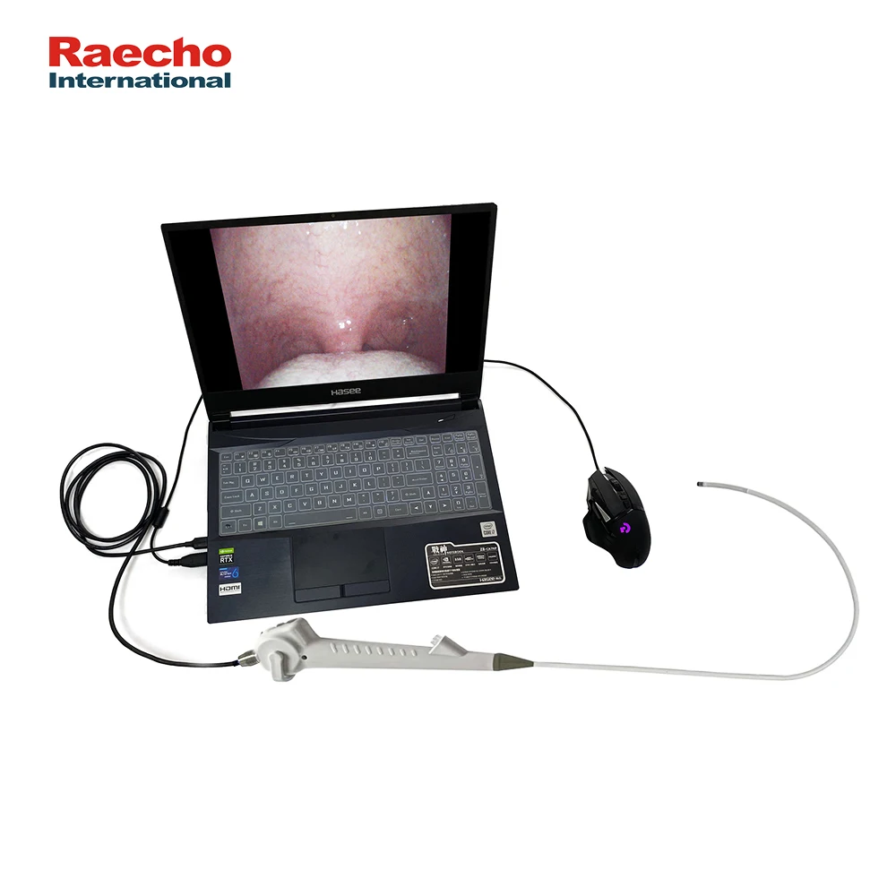 Disposable Video Ureteroscope ENT Ureteroscope Set Flexible Video Endoscope Digital Urological Ureteroscope