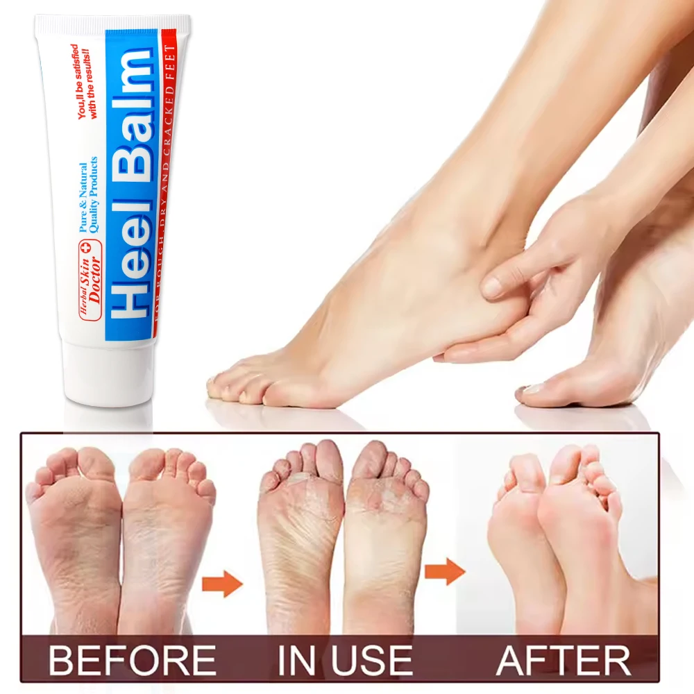 Herbal Frostbite Crack Foot Cream Oil Intensive Foot Repair Foot Cream Skin Healing Ointment for Cracked Heels Dry Feet