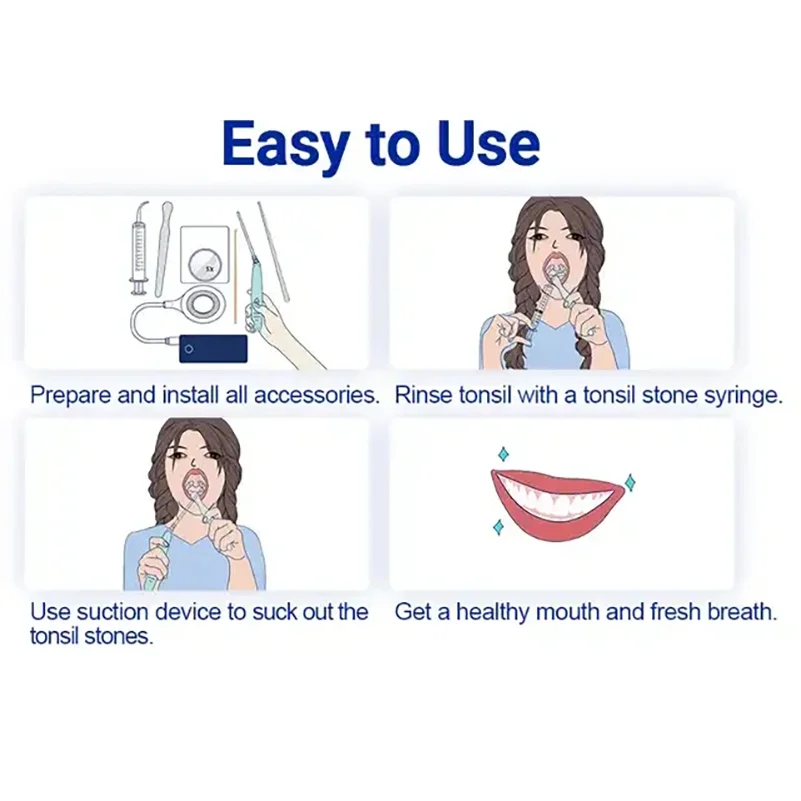 Nieuwe Elektronische Tonsil Steenzuiger Voor Mondverzorging, Vacuümsteenreinigingsset En Instant Zuiggereedschap Om De Mondgezondheid Te Verbeteren