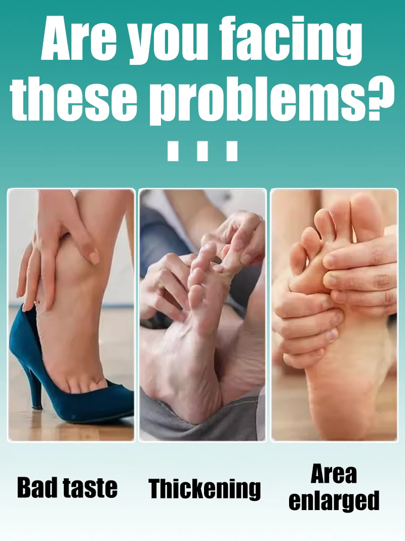 2025 Hot Sellers: Nail Cleaning Tools, Blue Light Laser Tools Root Repair Upgraded to Second Generation