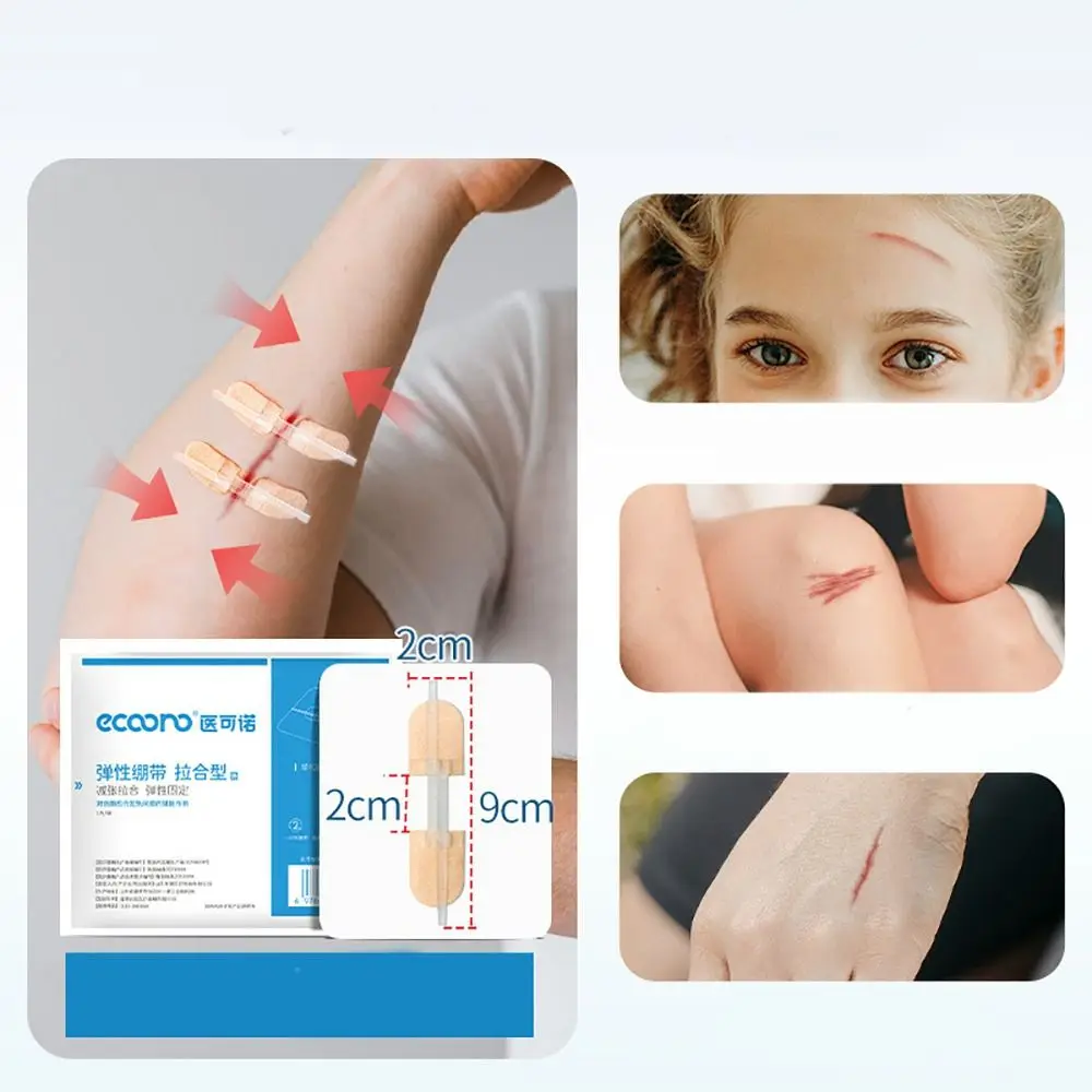 Adhesive Wound Care Zip Sutures Bandaids Without Stitches Emergency Zipper Laceration Repair First Aid Laceration Repair