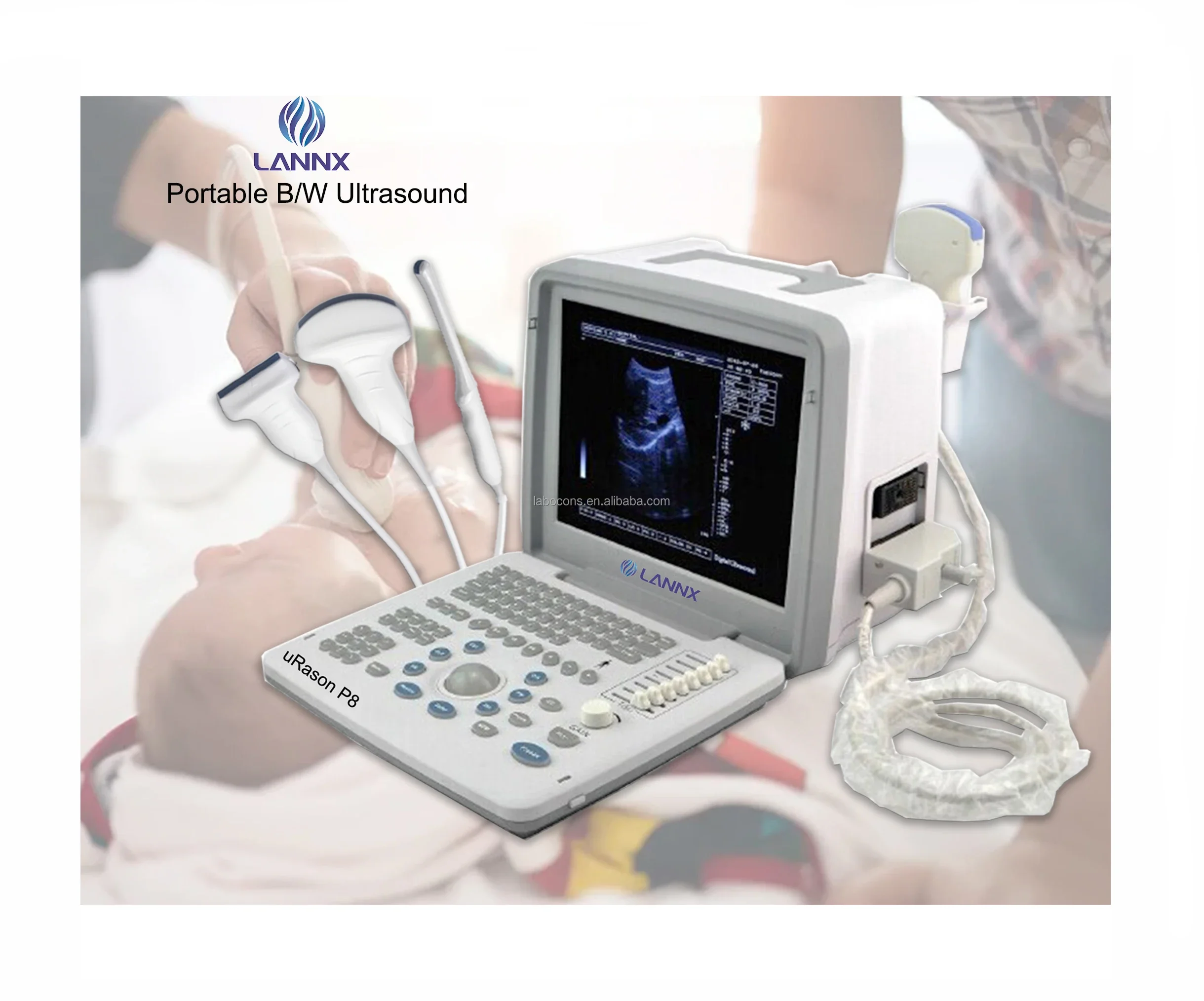 

LAN NX uRason P8 High cost-effective medical diagnostic ultrasound scanner device portable Notebook B/W USG machine