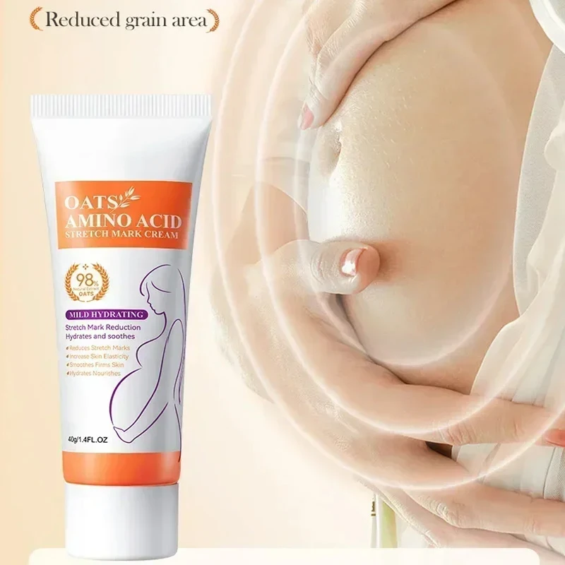 Removes Stretch Mark Cream To Remove Postpartum Obesity Pregnant Women Repair Anti-Aging Winkles Firming Body Cream Skin Care