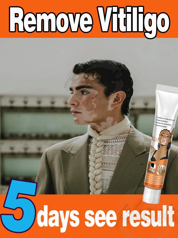 Crema de Vitiligo, esencia para el cuidado de la piel para hombre y mujer