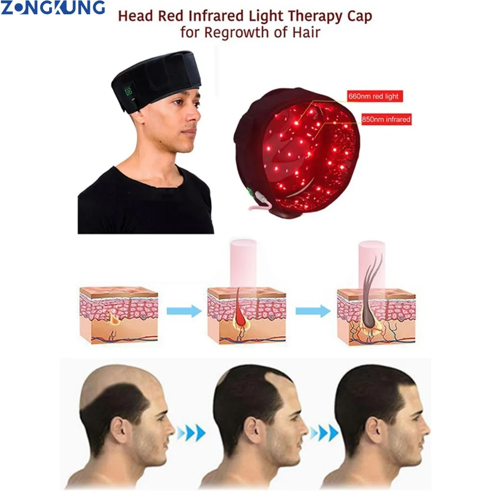 70Pcs Red Light Infrared Therapy Cap for Treatment Seborrheic Alopecia Areata Hair Growth Red Hair Growth Hat Device 635nm&850nm