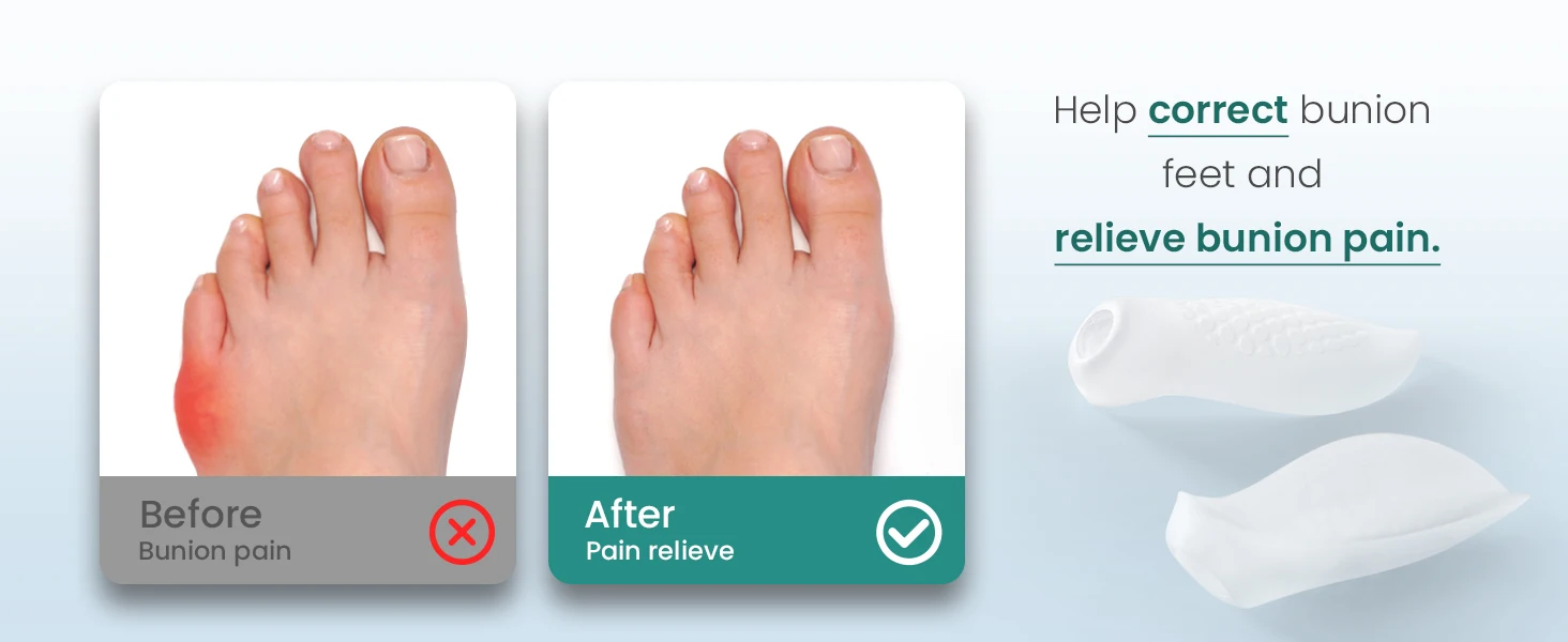

1/2Pairs Soft Gel Bunion Corrector Little Toe Separator Bunionette Pad Toes Pain Relief Feet Corn Callus Blisters Foot Care Tool