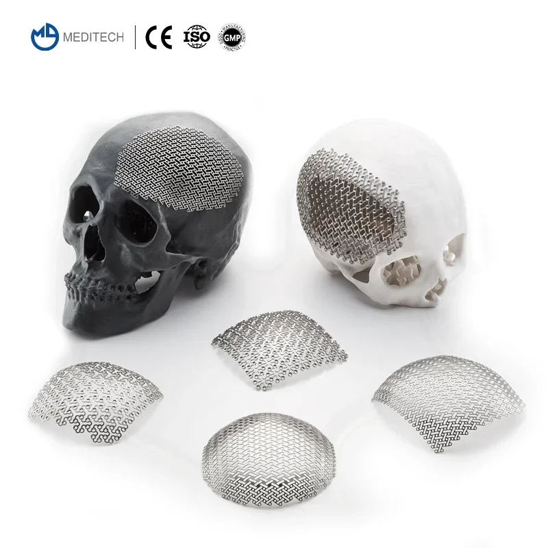 MEDITECH Chirurgisch Maxillofacial Neurochirurgie Systeem Cranial Titanium Mesh Plaat voor Schedel Cranioplastie