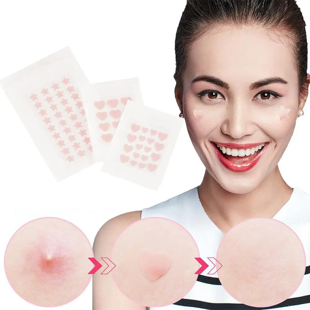 Stiker penghilang jerawat bintang, 12/18/36 buah stiker perawatan kulit Concealer Spot wajah aksesoris Makeup perawatan kecantikan kulit