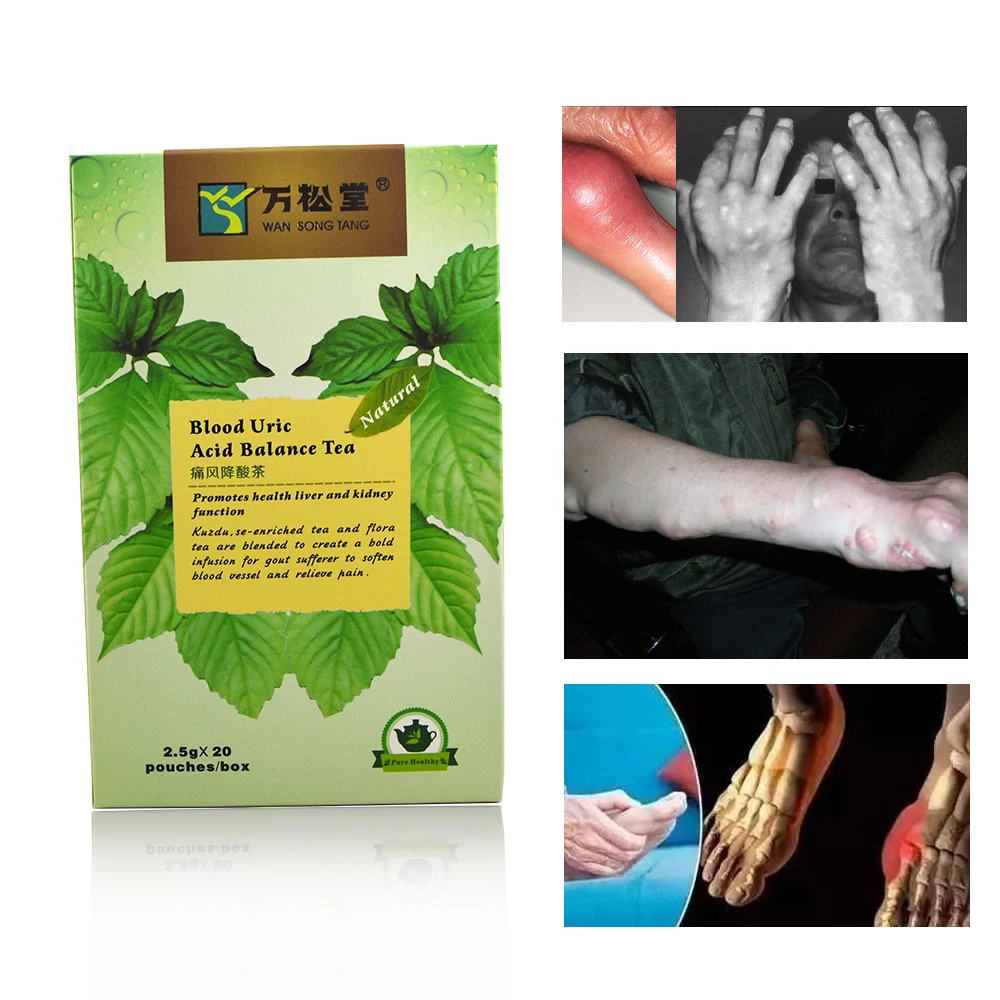 40 Pcs/2 Packs Herbal Blood Uric Acid Balance Gout Arthritis Treatment Diuretic Liver Kidney Booster Personal Health Care