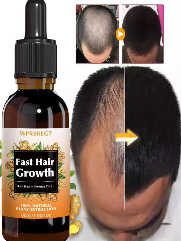 

Nᴀᴛᴜʀᴀʟ Hᴀɪʀ Rᴇɢʀᴏᴡᴛʜ Essᴇɴᴄᴇ - Nᴏɴ-Gʀᴇᴀsʏ & Fᴀsᴛ-Aʙsᴏʀʙɪɴɢ, Rᴇᴅᴜᴄᴇs Hᴀɪʀ Lᴏss & Bᴏᴏsᴛs Dᴇɴsɪᴛʏ, Fᴏʀ Aʟʟ Hᴀɪʀ Tʏᴘᴇs