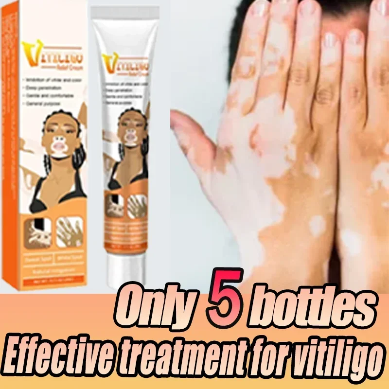 Vitiligo Safe Repair Brightening Lasting Increase Confidence Improve Skin Appearance Natural Ingredients