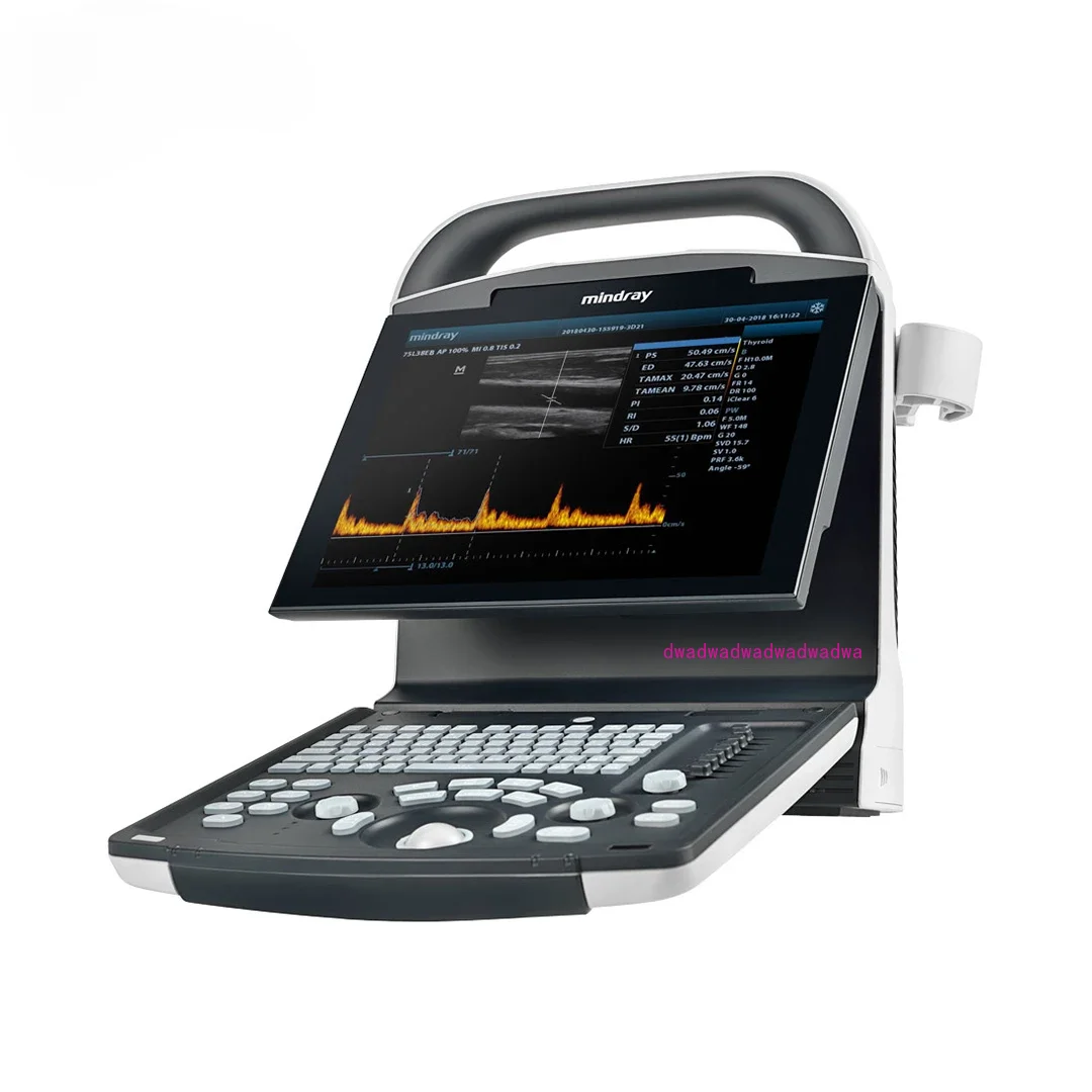 Mindray ultrasound dp 10 cheaper price Medical Ultrasound Instruments for hospital use