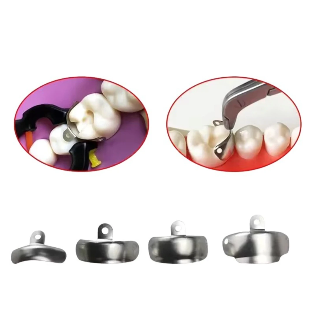 100 قطعة/صندوق M4 الأسنان المعادن مصفوفة الفرقة احيط الاقسام نظام مصفوفة لاستعادة الأسنان أدوات طب الأسنان 3.5/4.5/5.5/6.5 مللي متر