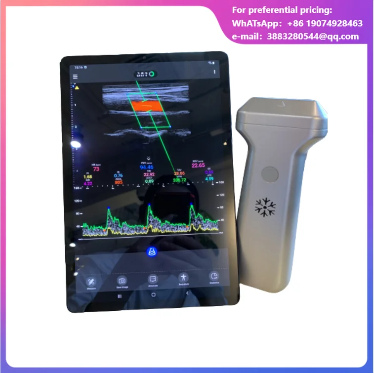 Mini Wireless Linear Probe Ultrasonic Scanner Portable Convex Transducer Electric Power Source Made Metal Plastic 6000mAh