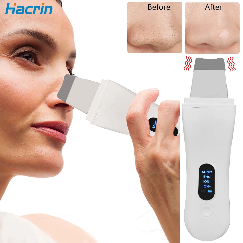 Ultrasonic Skin Scrubber Peeling Blackhead Remover Ion Acne Pore Cleaner Deep Face Cleaning Ultrasonic Facial Shovel Scrubber