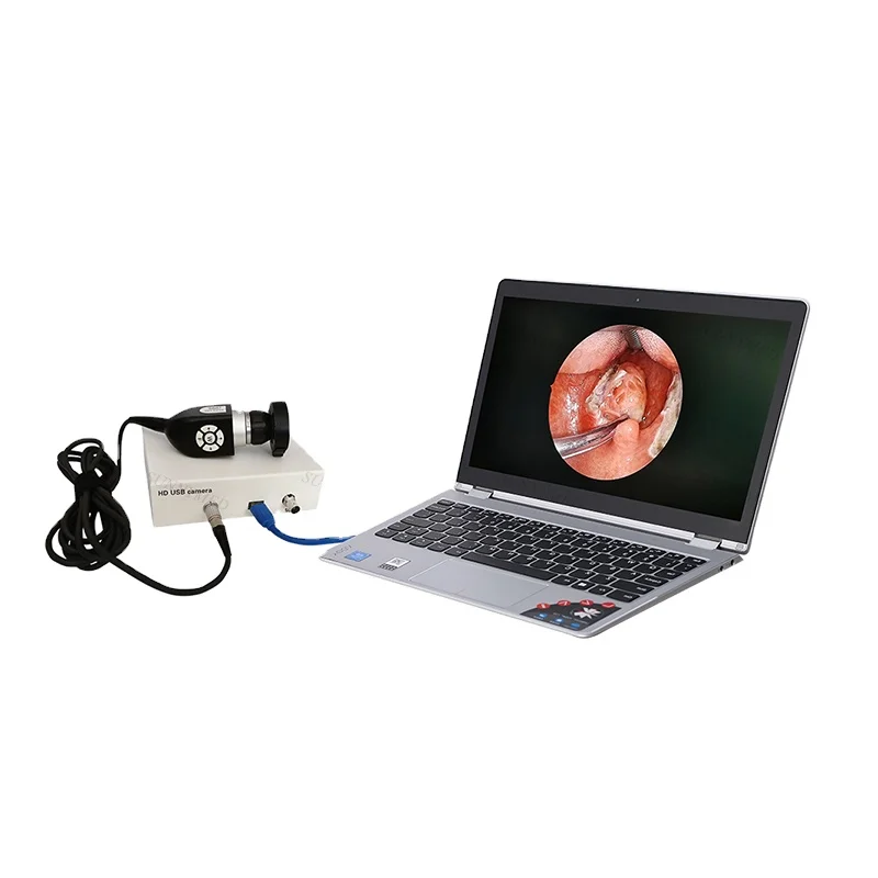 SY-P031HD2 veterinary video endoscopic hd video endoscopic camera-