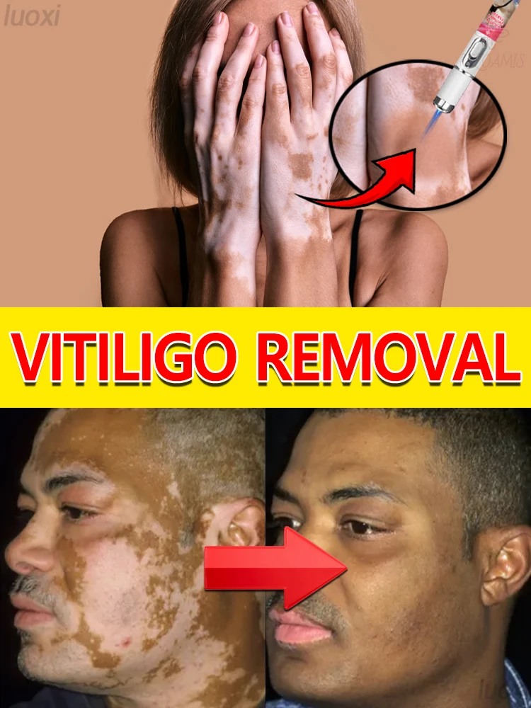 

ʸᵒᵘ ʷⁱˡˡ ʰᵃᵛᵉ ᵃ ᶜᵒᵐᵖˡᵉᵗᵉ ˢᵏⁱⁿ ᶜᵒˡᵒʳ ᵒⁿ ʸᵒᵘʳ ᵇᵒᵈʸ