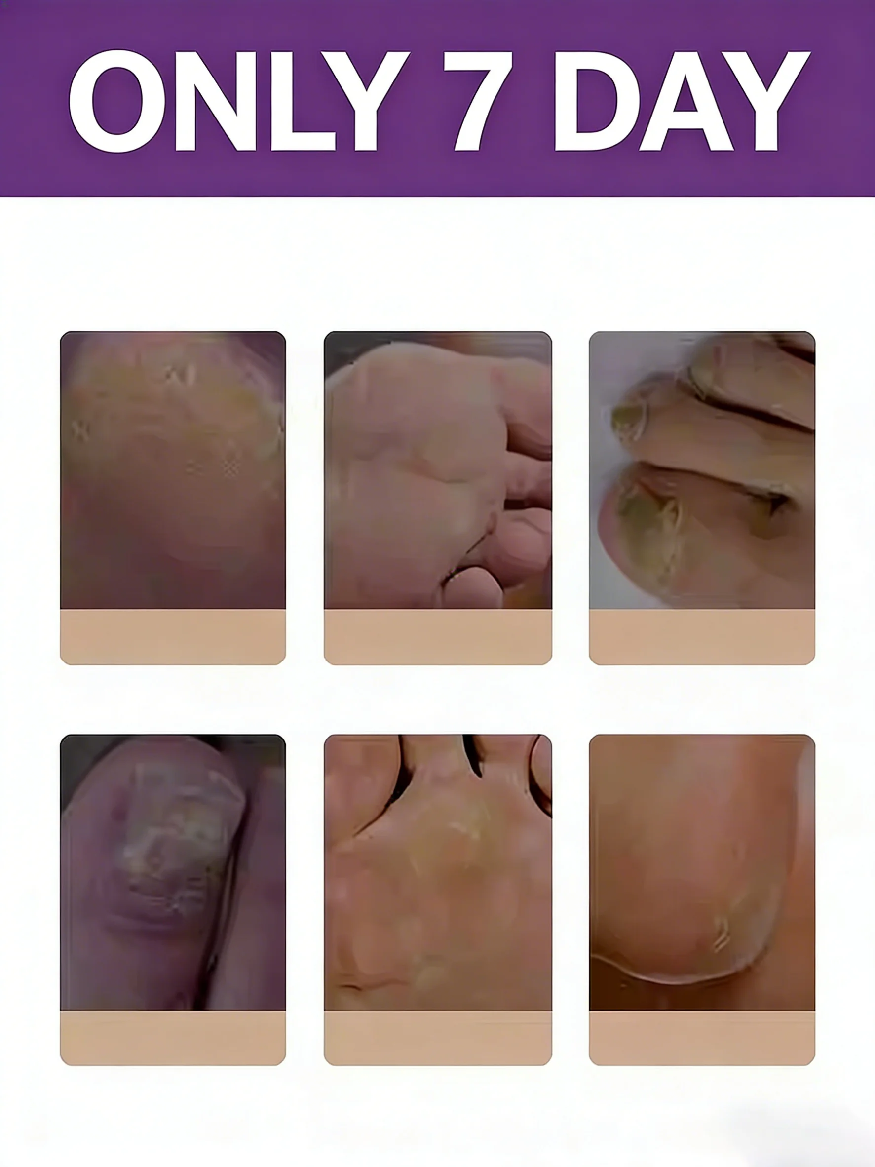 The fifth-generation champagne-colored laser pointer helps you say goodbye to your troubles. Technology changes your life.