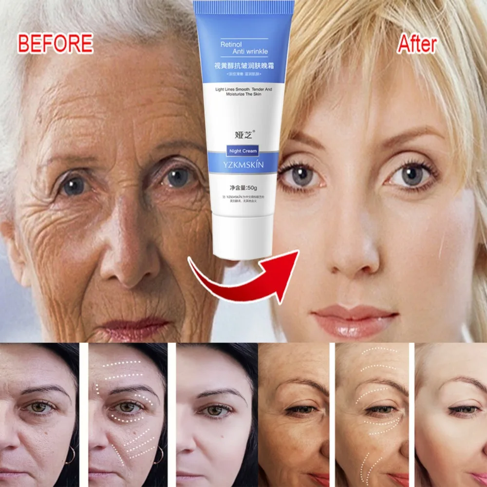 Retinol Remove Wrinkle Cream Anti Aging Lifting Firm Creams Fade Fine Lines Whitening Tighten Korea Skin Care Cosmetic