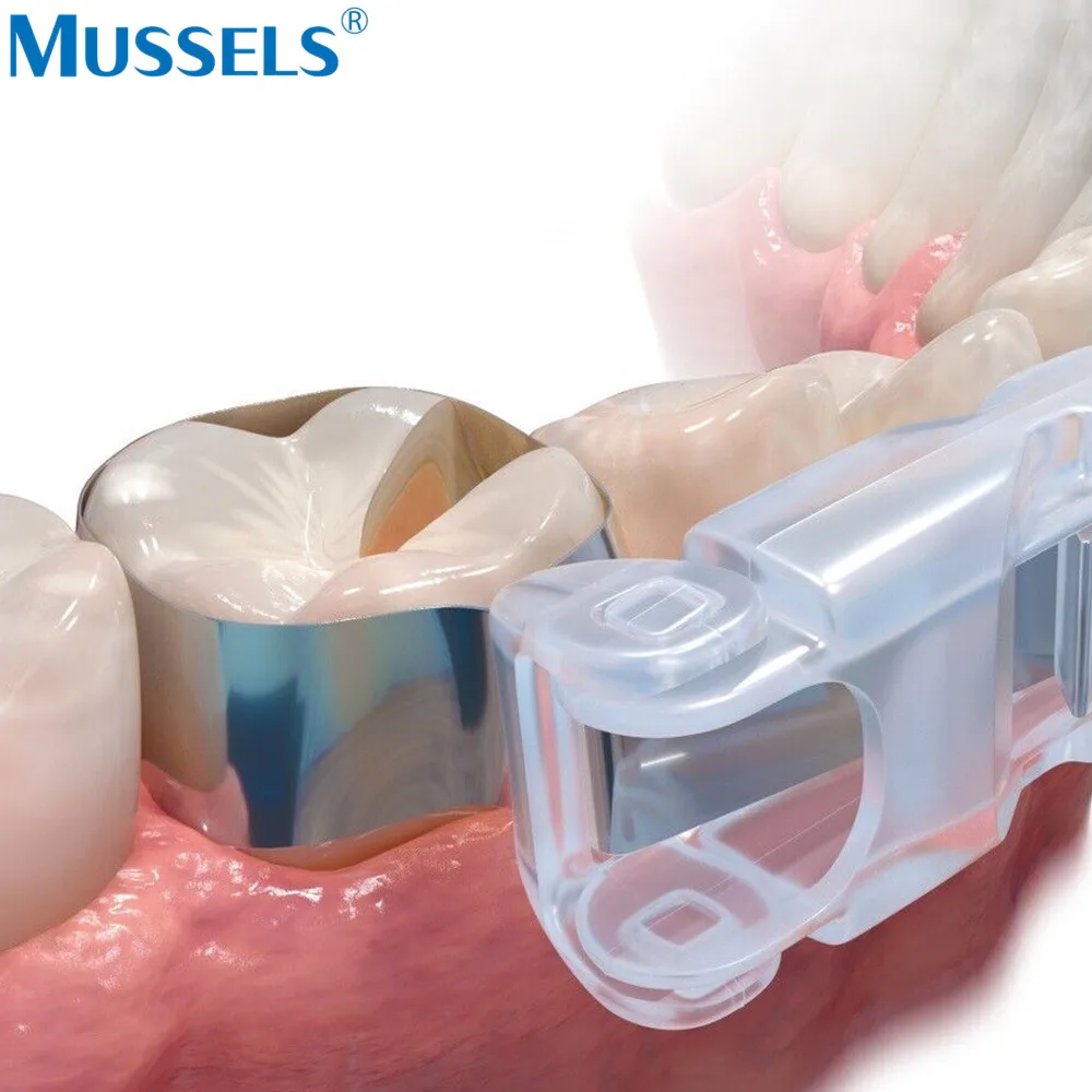 Verstelbare Tandheelkundige Pro Matrix Banden Voorgevormde Sectionele Metalen Matrice Ring Molar Restauratie Tanden Vullen Retainer Tandarts Tool