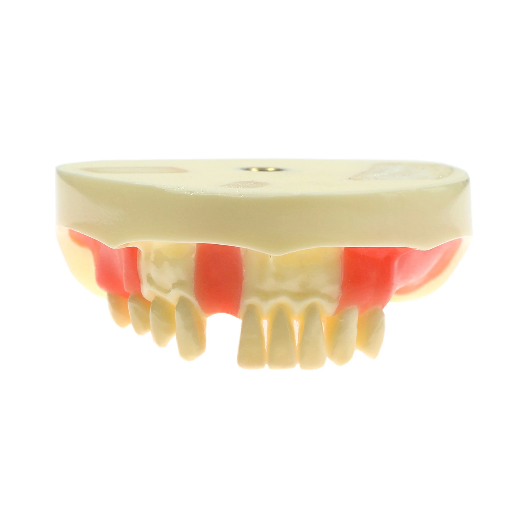 M2004 Dental Implant Practice Model Lower Jaw Teeth Model Removable Gingiva Restoration Teaching and Research