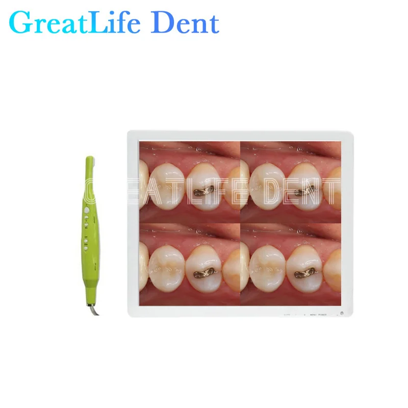 GreatLife 17 Inch Dental Unit Type PIP USB Oral Camera Intraoral Intraoral Camera Monitor Intra Oral Camera Auto Focus