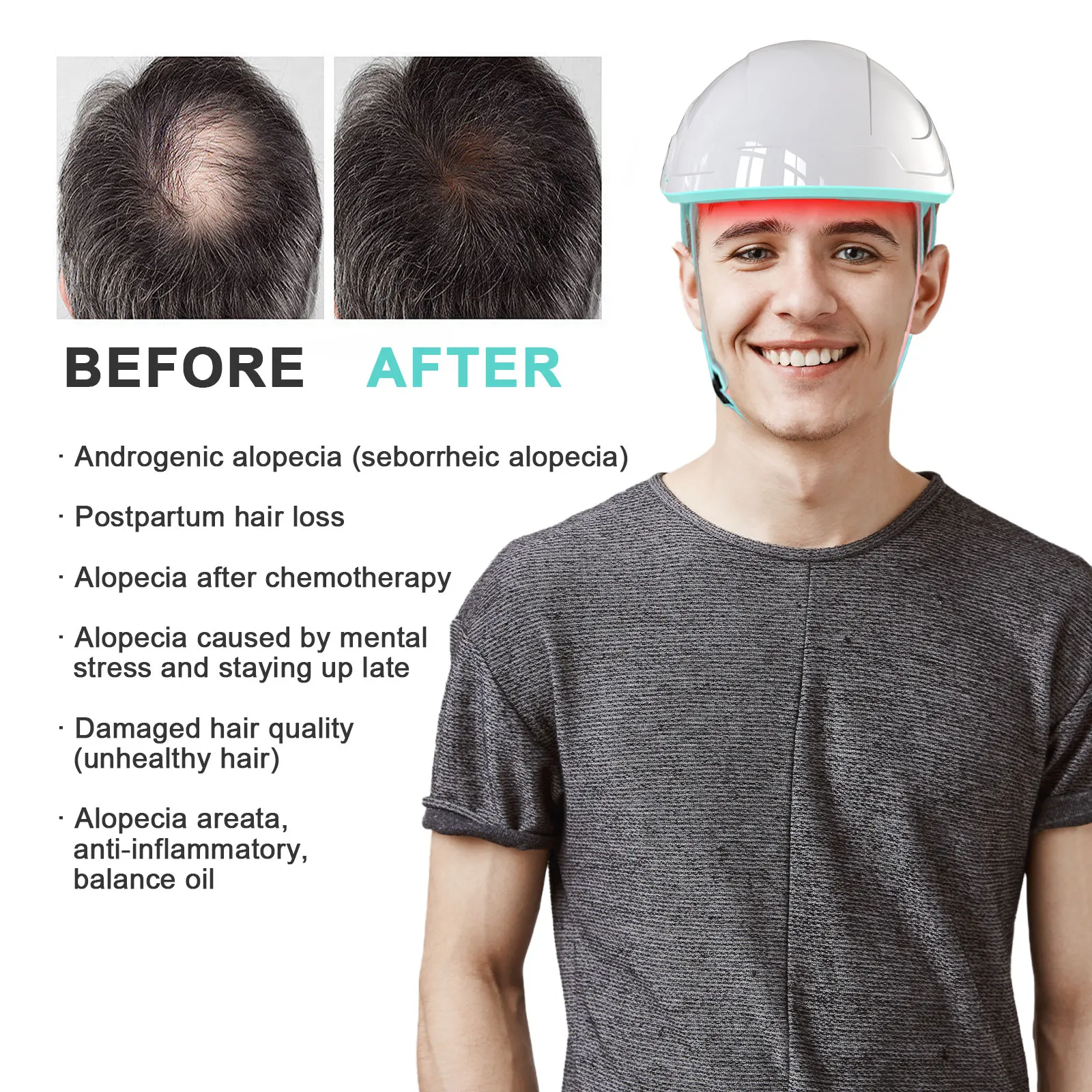 قبعة ليزر لنمو الشعر من LaseLocks مضادة لتساقط الشعر مع 109 قطعة ثنائيات ليزر 660 و850 نانومتر تقلل من الزيت العميق في بصيلات الشعر