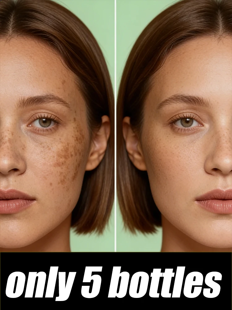 

2026 hot sale,Facial cleansing solve spots,Facial cleansing tools, unisexx
