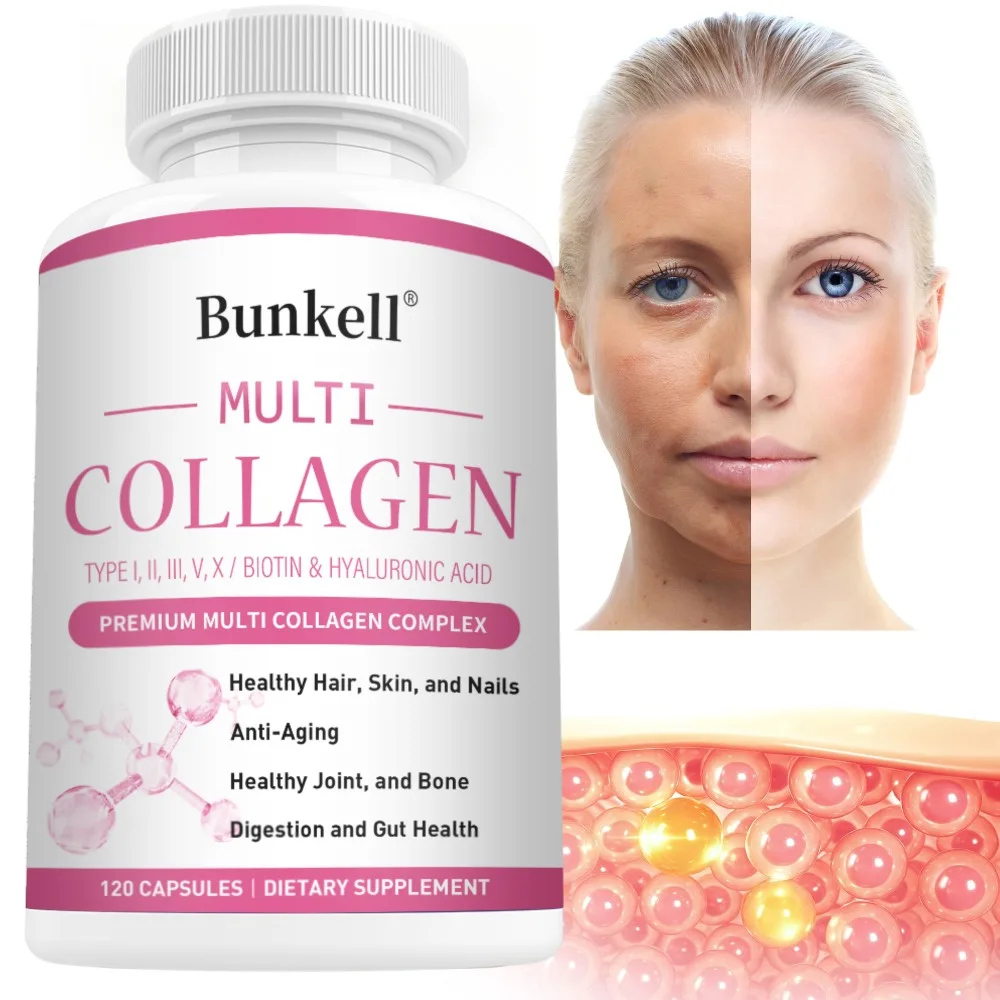 High Strength Multi-Collagen Complex Capsules – Hydrolyzed Peptides for Skin, Hair, Nails & Joints, Non-GMO