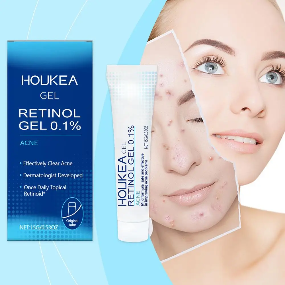 Acne‑Treatment Facial Gel Gentle Daily Skin Repair Cream Clear Pimples Blackheads Soothe Sensitive Acne‑Prone Skin