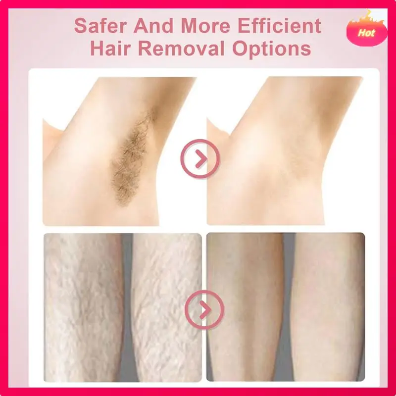 

AD-Женский портативный эпилятор, подходящий для женского эпилятора для удаления волос