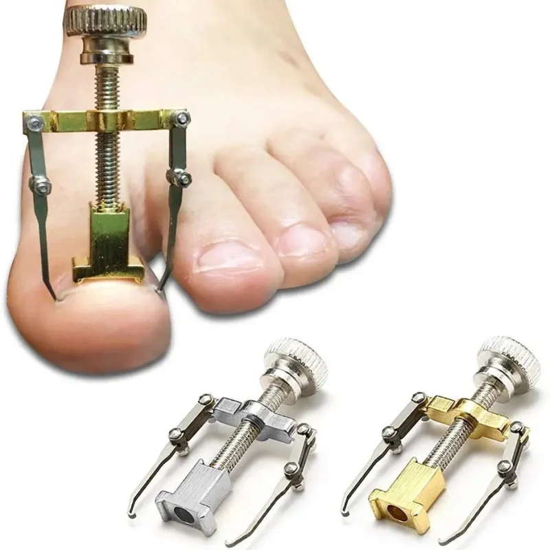 Stainless Steel Ingrown Toenail Corrector Curved Nail Straightener Orthopedic Brace File Tool Kit Ultra Safe Durable Ergonomic