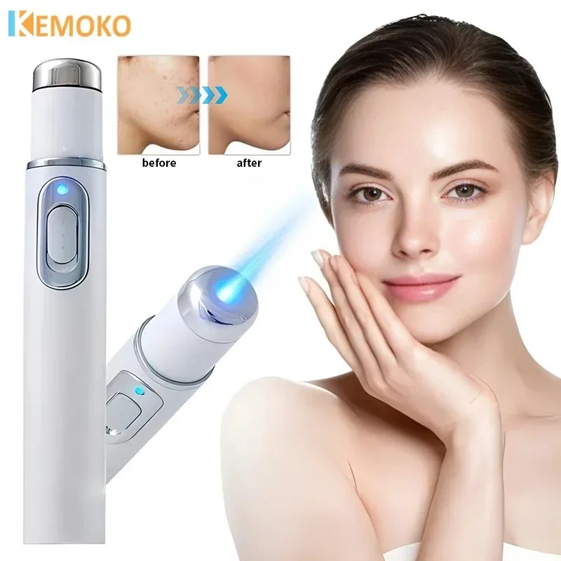 

Varicose Vein Lampshade Therapy Effective Relief Of Dilated Vasculitis In The Legs Phlebitis Improved Blood Circulation SkinCare