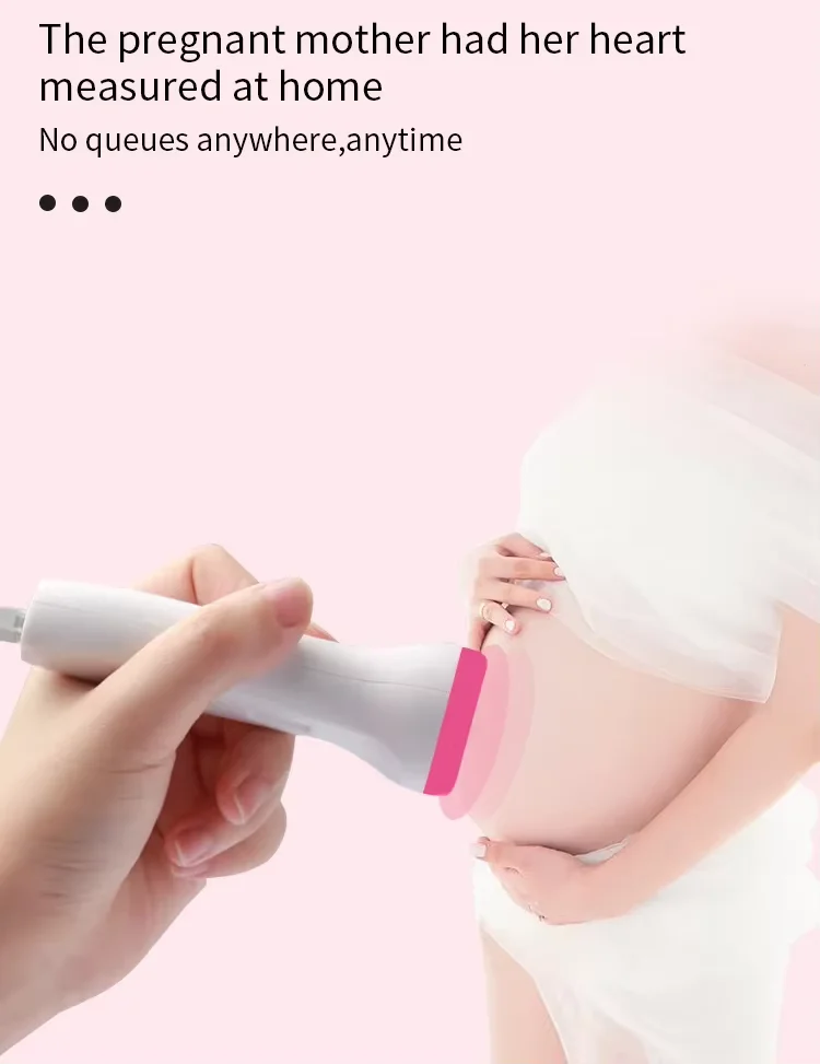 Medical ultrasound gel Fast Hair Removal Spray Painless Hair Growth Inhibitor Arm Armpit Leg Permanent Depilatory for Men Women
