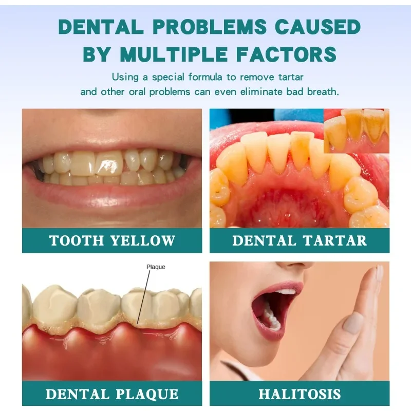 เอสเซนส์ยาสีฟันทำความสะอาดฟันสีเหลืองทาร์ทาร์ขจัดคราบจุลินทรีย์เซรั่มช่วยให้ลมหายใจสดชื่นซ่อมแซมสุขภาพช่องปากน้ำยาฟอกขาว