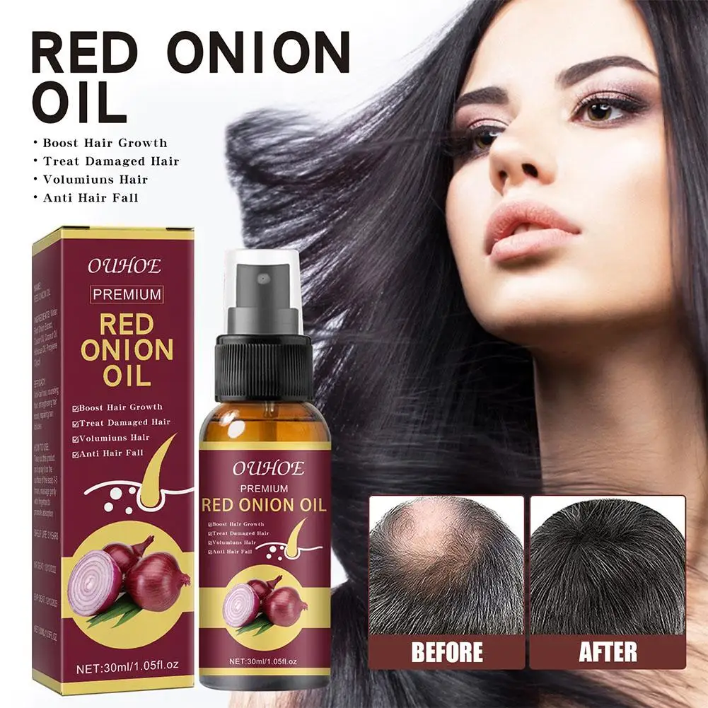 OUHOE Red Onion Essential Oil Spray Extract Strong And Moisturized Hair For Hair Care And Growth Prevent Hair Loss H5M8