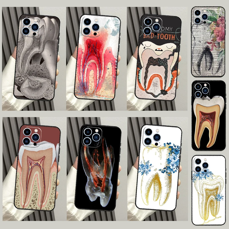 Human Tooth Anatomy Case For Samsung Galaxy M33 M21 M31 M16 M36 M56 M53 M13 M12 M32 M52 M15 M55 M14 M35 M34 M54