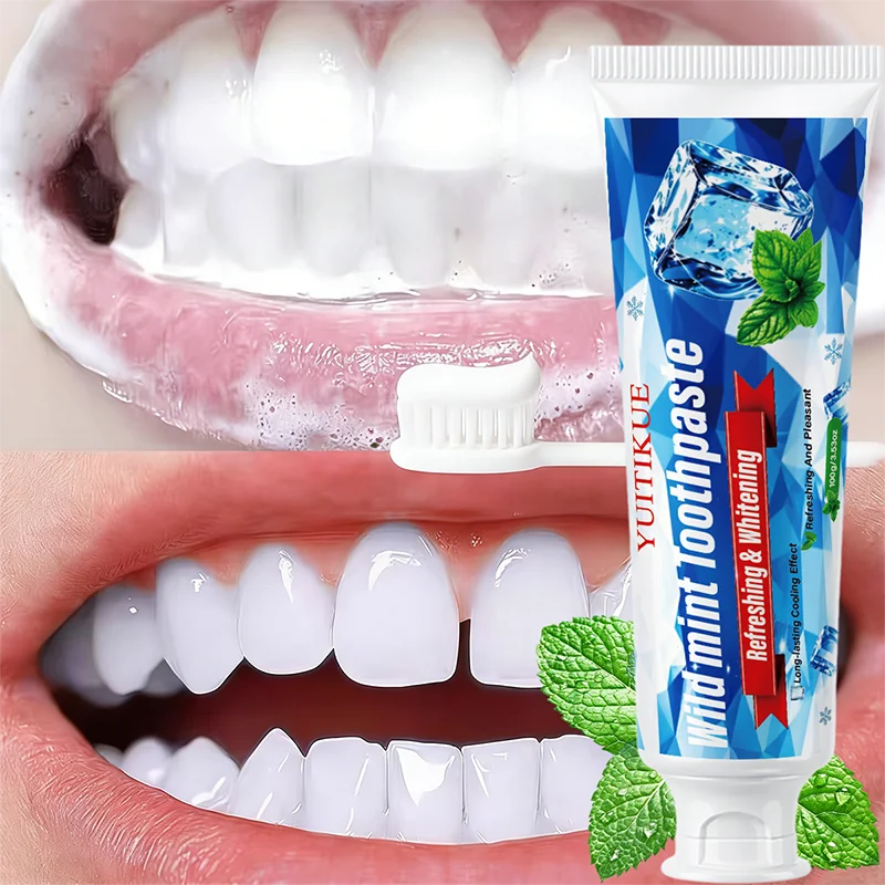 Teeth Whitening Paste - YUITIKUE Cooling Mint Teeth Whitening Toothpaste