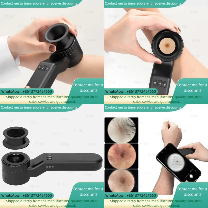 iboolo-dermatoscope-accessory-eye-piece-for-de-4100-dermatoscope