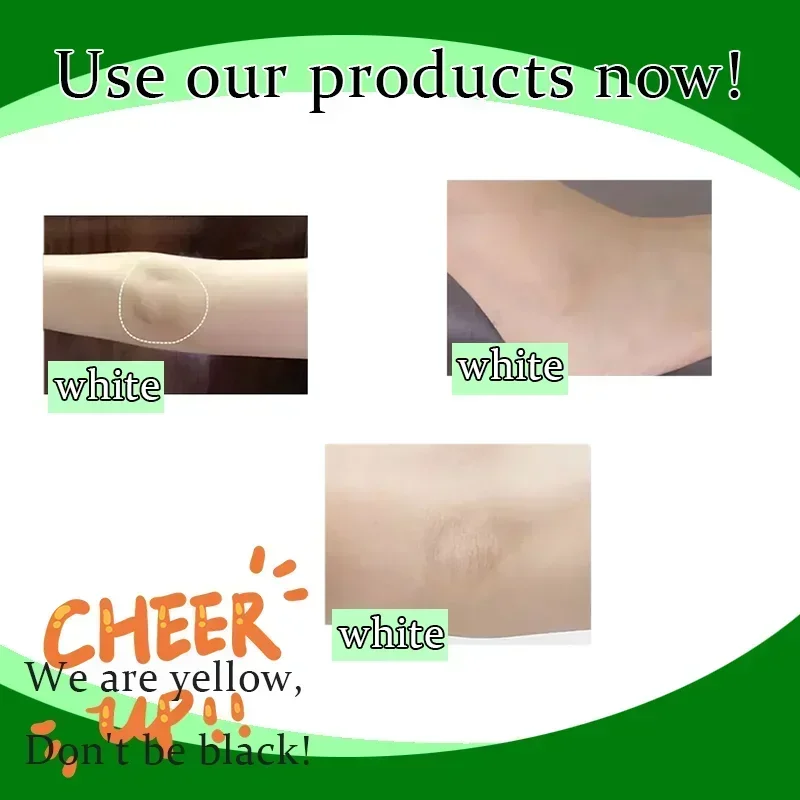 Effective Improve Body Whitening Cream Armpit Legs Knee Elbow Bleaching Cream Dull Remove Dark Spots Melanin Brighten Skin Care