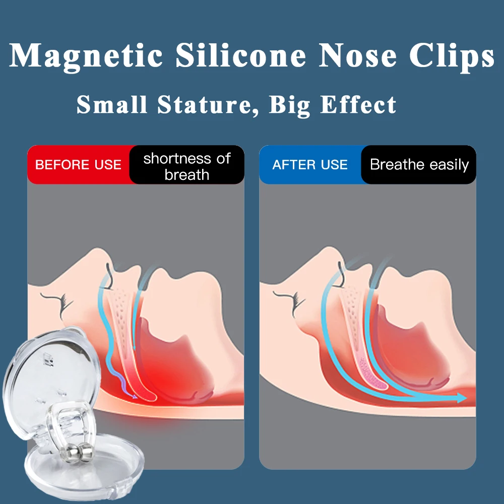 Korektor Anti dengkur, Gel silika pencegahan dengkuran klip hidung, alat bantu tidur Pembersih Anti mendengkur