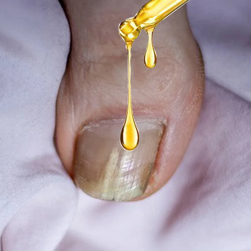 

Discolored Damaged Nail Foot Care Tool Toenail Fungus Patch Waterproof Nail Repair
