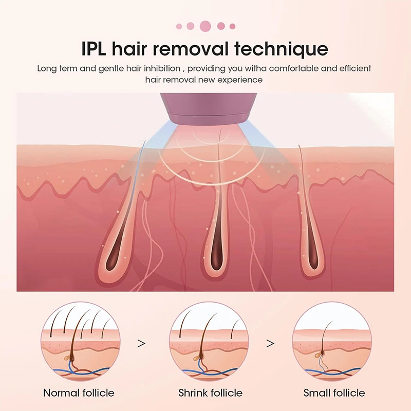 Thumbnail 4 - #78 Compare IPL Devices Before You Buy