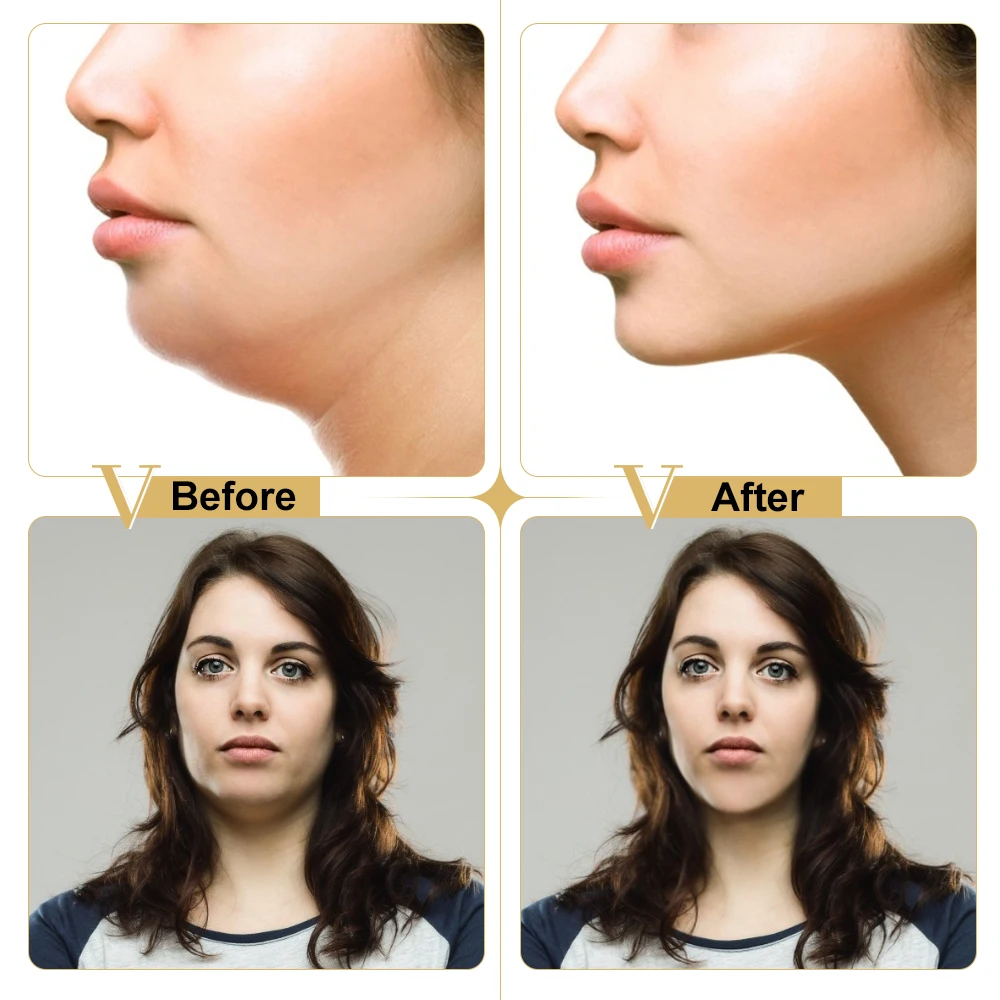 Shaped V Face Tightening Moisturizing Fade Double Chin Fine Lines Improve Firmness Sagging Skin Lifting Repair Care