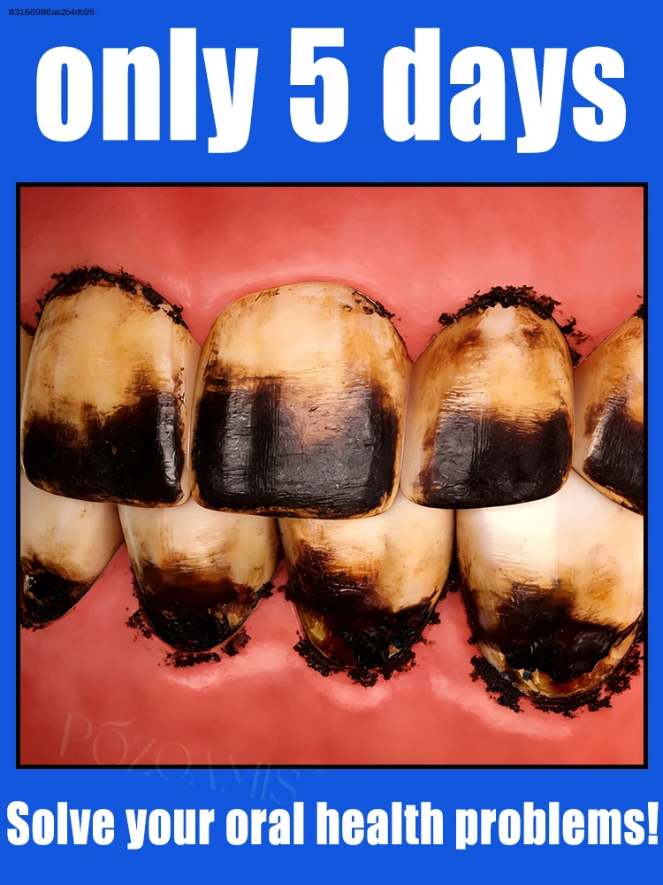 

Покажите блестящие белые зубы и забудьте о неловкости из-за желтизны зубов.