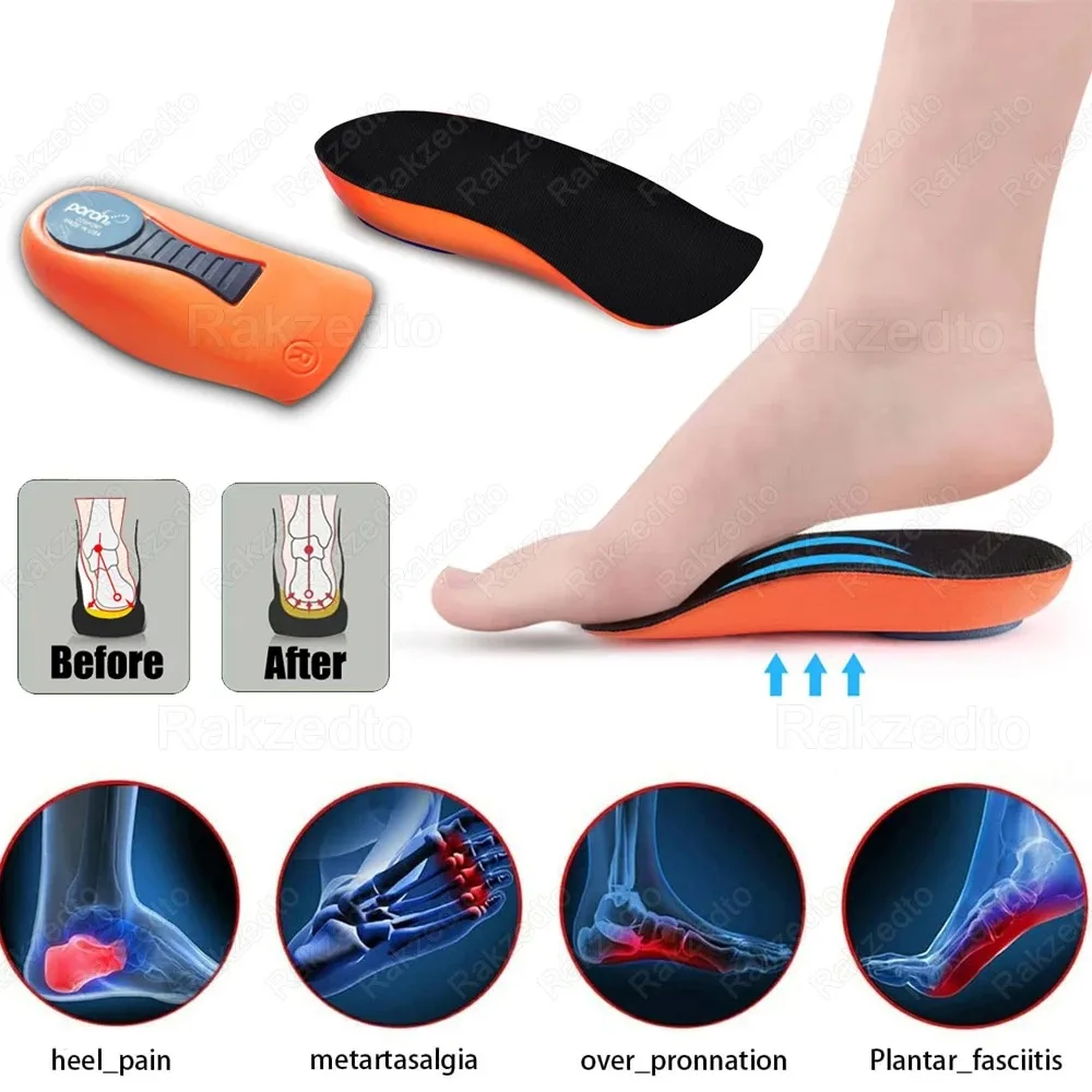 Thumbnail 2 - #25 Low Cost Heel Spurs That Work